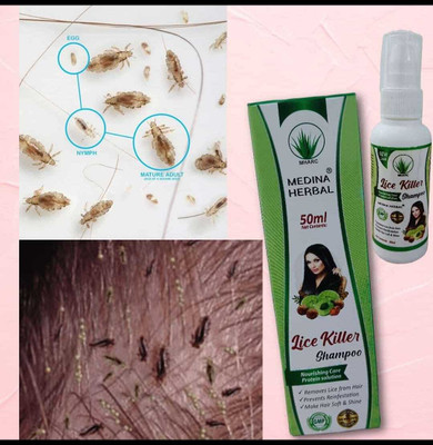 MEDINA HERBAL Lice Killer Shampoo(50 ml)