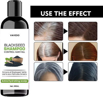 RKD Scalp Nourishing Shampoo | Blackseed-Based Hair Fall Control(100 ml)