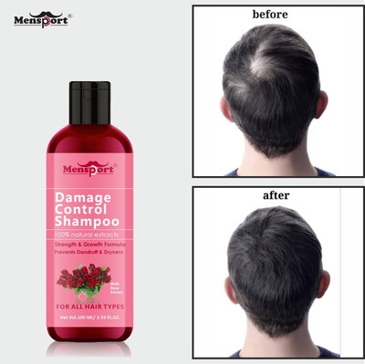 Mensport Damage Control Shampoo with Rose Extract for Dandruff Control Pack 1 of 100ML(100 ml)