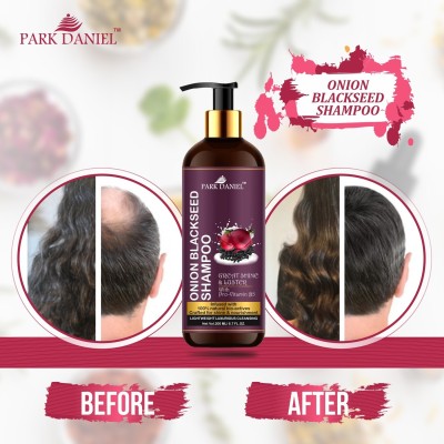 PARK DANIEL Premium Onion Blackseed Shampoo - For Great Shine and Luster Hair Combo Pack 3 Bottle of 200 ml(600 ml)(600 ml)