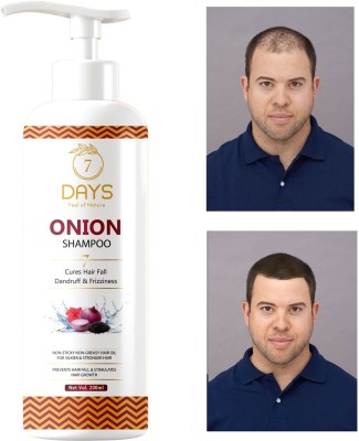 7 Days Premium RED ONION OIL Herbal Shampoo For Faster Hair Growth Men & Women 100 ml(100 ml)