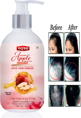 vaydo Apple Cider Vinegar Shampoo for Dry, Frizz-Free & Stronger Hair(300 ml)