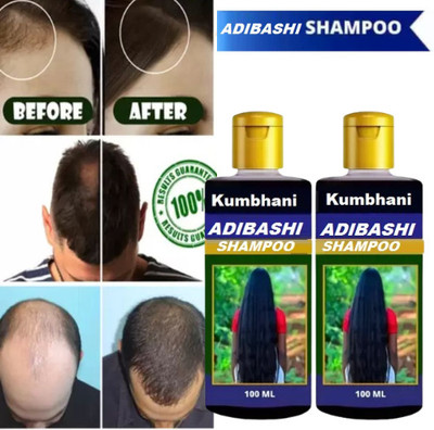 Kumbhani Adibashi SHAMPOO FOR ALL HAIR PROBLEM(200 ml)