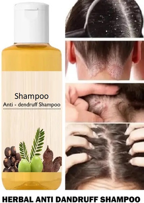 GFSU - GO FOR SOMETHING UNIQUE Anti-Dandruff Shampoo Anti Dandruff Shampoo For Men women(100 ml)
