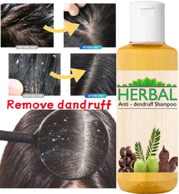 ADJD herbal Amla and Bhringraj Shampoo For Women and Men 100ml(100 ml)