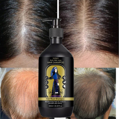 vvqvv Ginger Essence Hair Regrowth Shampoo – Stimulate Follicles & Enhance Volume(300 ml)