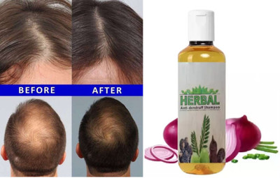 ADJD Smooth Naturally Soft Silky Hair Shampoo(100 ml)