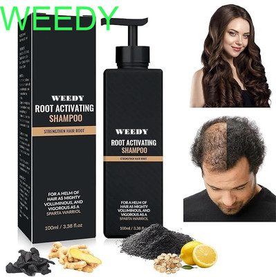 WEEDY Root Activator Shampoo for Healthier Hair Follicles(100 ml)