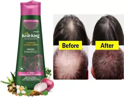 Kesh King Ayurvedic Onion Shampoo HairFall Expert(300 ml)