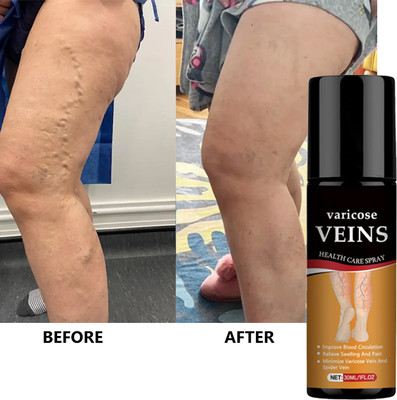 house of common Anti-Varicose Herbal Spray – Reduces Pain, Improves Leg Comfort Spray(30 ml)