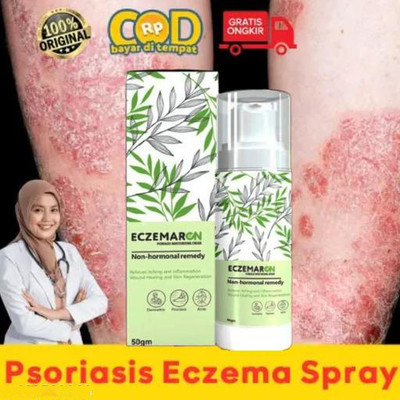 EDITH NATURALS Ayurvedic Eczemaron Eczema & Fungal Infection Anti Fungal Cream For Men & Women(50 g)