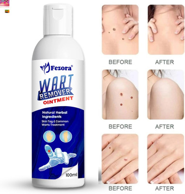 fezora Wart Remover Ointment Wart removal Cream(100 ml)