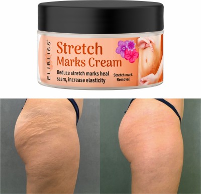 ELIBLISS Anti-Stretch Marks Cream Reduce Pregnancy Stretch Marks, Itching & Irritation(50 g)