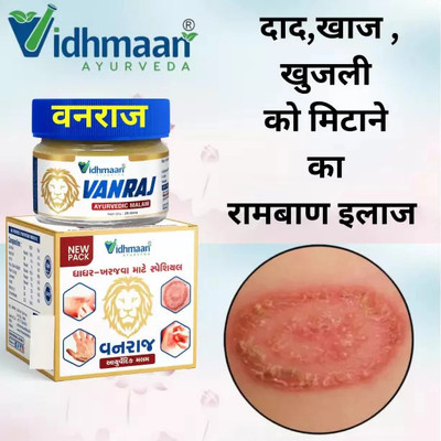 vidhmaan ayurveda Vidhmaan Ayurvedic VANRAJ Anti FunGal Ointment - Effective for and Fungal Infections(25 g)