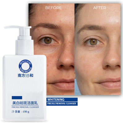 VITRACOS Whitening Freckle Removal  – Glow & Refresh Face Wash(150 g)