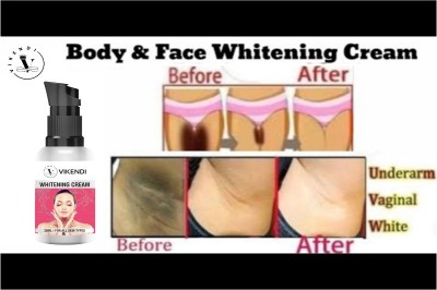 VIKENDI Whitening Cream For Skin Whitening, Reduces Dark Spots And Skin Ageing(30 ML)(30 g)