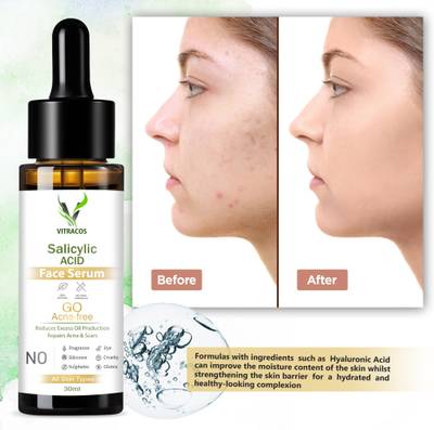 VITRACOS Salicylic Acid Serum for Acne, Blackheads & Open Pores - Exfoliating BHA Serum For Oily Skin