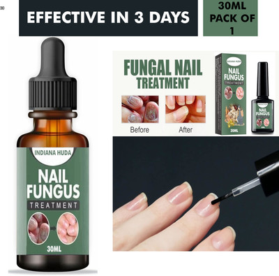 Buy TYA Nail fungus treatment solution, home remedy for nail health 30ml(30 ml)