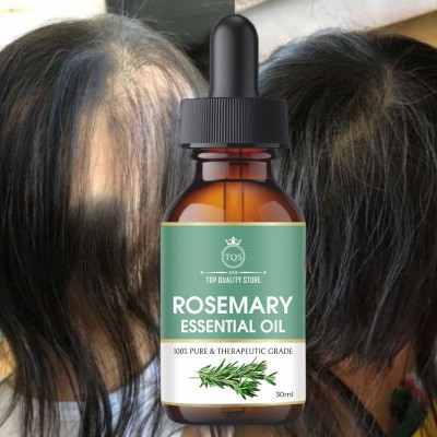 Top Quality Store Rosemary Natural Oil for Hair Growth Anti Dandruff Control(30 ml)