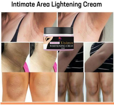 Woman Beauty wb natural Dark UnderArm Whitening Cream For Dark Neck,Knuckles Elbows Whitening(50 g)
