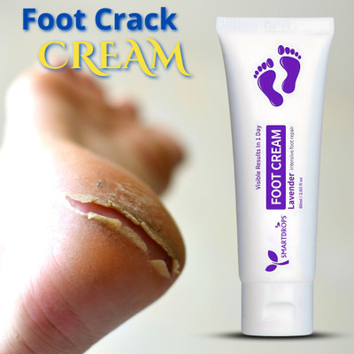smartdrops Hand & Foot Crack Cream for Crack, Dry & Dehydrate(60 ml)