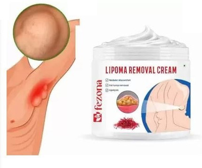 FEZONA Lipoma Removal Cream Fat Lump Remover Treatment With A Hassle-Free Experience(100 g)