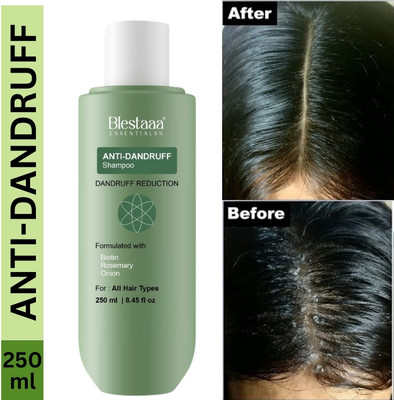 blestaaa essentialss Anti-Dandruff Shampoo - Strengthens Hair with Salicylic Acid & Biotin.(250 ml)
