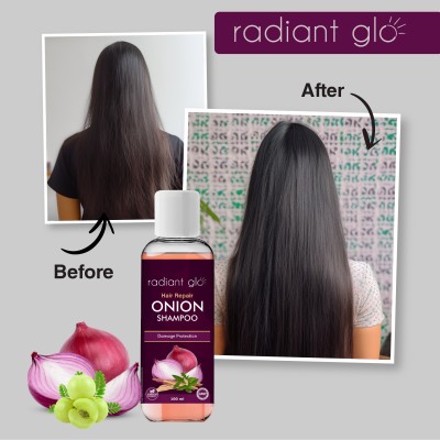 Radiant Glo Onion Shampoo - Hair Repair & Damage Protection | 100 ml x Pack of 3(300 ml)