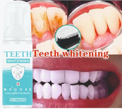 SKOOKUM Teeth Whitening foam Make your Teeth White n Sparkle Teeth Whitening Teeth Whitening Kit
