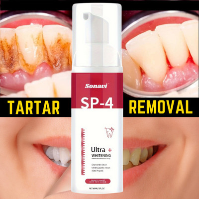 Sonavi Teeth Whitening Foam To Remove Yellow Stains | Mint Flavour Teeth Whitening Kit