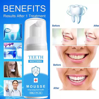 Prifakt Toothpaste Foam Sensitivity Relief, Bad Breath Teeth Whitening Foam Toothpaste(60 ml)