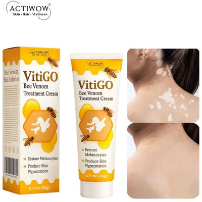 ACTIWOW Vitigo Bee Venom Cream for Refreshing Skin Prep(100 g)