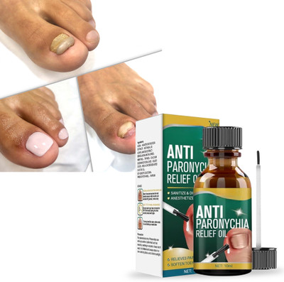 BEUTISKY Anti Paronychia Nail Cure Oil for Deep Healing, Protection & Recovery(10 ml)