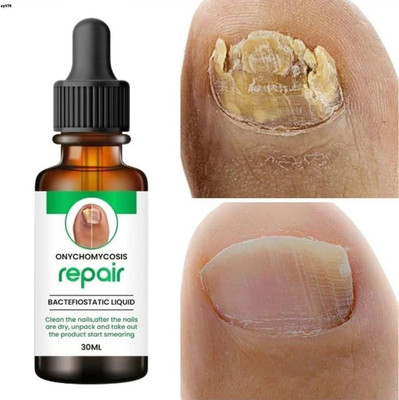 K3NTERPRISES Fast Action Nail Therapy Edition 347(30 ml)