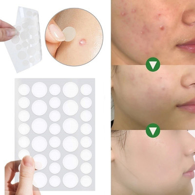 FLORERO 36 pcs Face Skin Care Acne Pimple Patch(20 g)