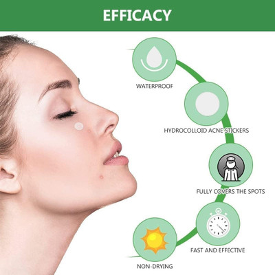 REIMICHI 36 Pimple Patches,Spot Patches,Acne Patch,Hydrocolloid Patches,Acne Pimple Patch(36 g)