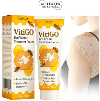 ACTIWOW Vitigo Bee Venom Cream for Dry Patch Repair Cream(100 g)