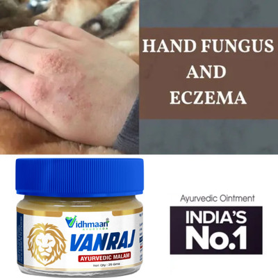 vidhmaan ayurveda Ayurvedic vanraj Skin Care Cream Treatment for Ringworm, Anti Itching, & Anti Fungal Infections| Quick Relief itching cream(25 g)