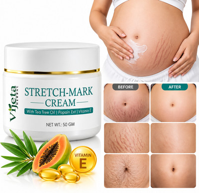 VIJETA Anti Stretch Mark Cream, Reduce Pregnancy Stretch Marks & Scars For Women(50 g)