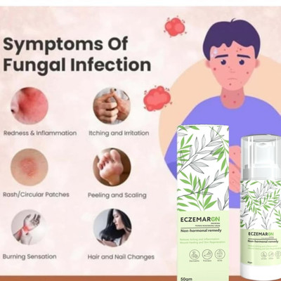 Eczemaron Ringworm New Anti Fungal Cream For Men & Women(50 g)