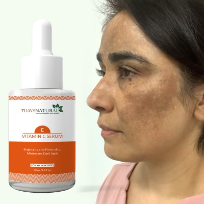 7days natural Vitamin C Serum for Face GLOW With niacinamide for skin Brightening Whitening | Anti Dark Spot | Acne(30 ml)