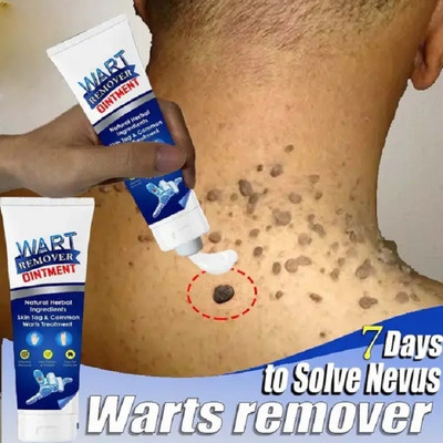 EVERERIN Wart remover cream for wart Free Skin for man or women mole remover(100 g)