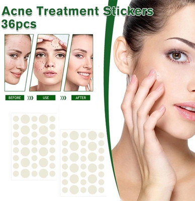 tanvi27 Pimple Acne Patch Hydrocolloid Waterproof Patches Active Surface Acne(10 g)