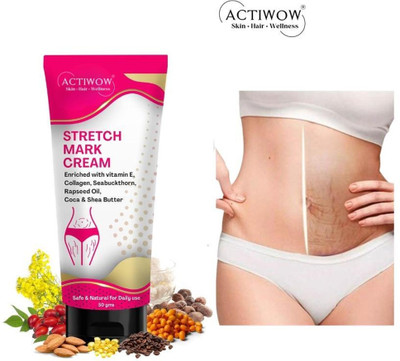 ACTIWOW Stretch Marks Removal Tube For, Heal While You Sleep CM01(50 g)