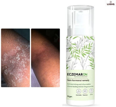 LORSHEL Eczemaron Fungal Cream - Advanced Treatment with Gentle on Skin(50 ml)