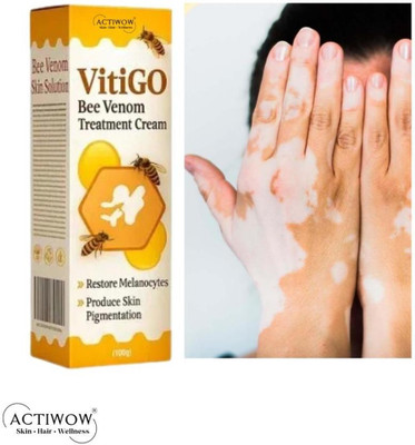 ACTIWOW Vitigo Bee Venom Cream for Clean Skin Feel(100 g)