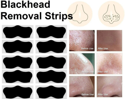 house of common Good Nose Strips for Women Painless & Instant Removal of Whiteheads(10 g)