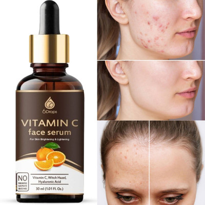 6Drops Vitamin C Face Serum, Skin Lightening, Whitening & Brightening Serum 30g(30 g)