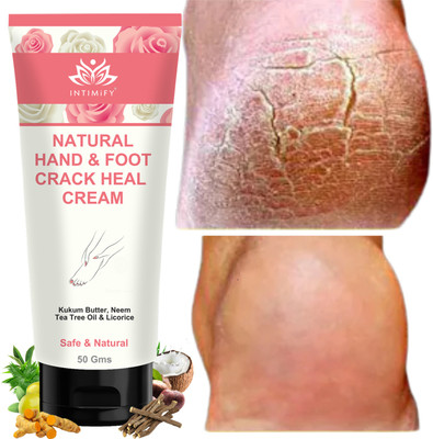 INTIMIFY Crack Heel Repair Cream, Up To 24 Hours Of Moisturization(50 g)