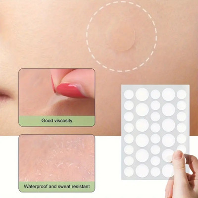 WOONGMI Pimple Acne Patch Hydrocolloid Waterproof Patches For Men And Women(10 g)